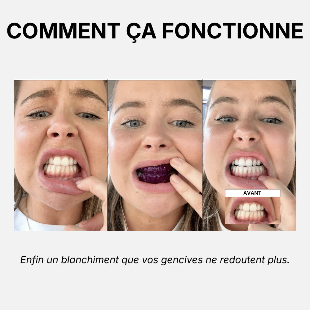 Bandes Blanchissantes Violettes