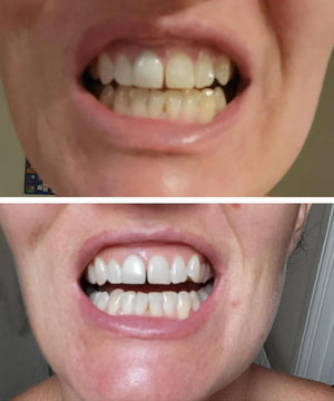 Client utilisant SMILY